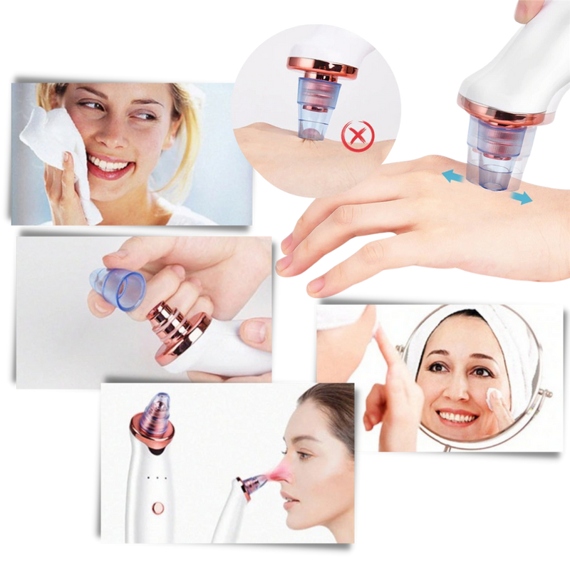 Petit aspirateur extracteur de points noirs